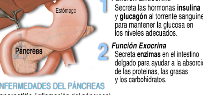 ¿Por qué se llama diabetes? ¿Por qué se llama diabetes?