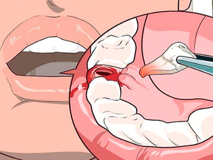 ¿Por qué se llama El Cuarto de Atrás? ¿Por qué se llama El Cuarto de Atrás?