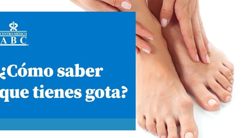 ¿Por qué se llama gota? ¿Por qué se llama gota?