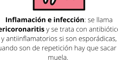 ¿Por qué se llama la muela del juicio? ¿Por qué se llama la muela del juicio?