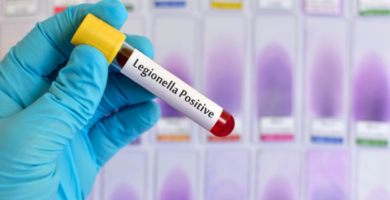 ¿Por qué se llama legionella? ¿Por qué se llama legionella?