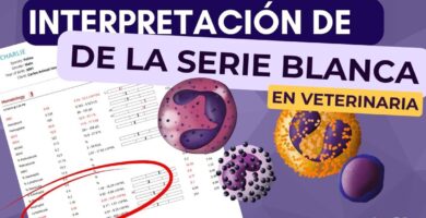 ¿Por qué se llama leucocitosis con desviación derecha? ¿Por qué se llama leucocitosis con desviación derecha?
