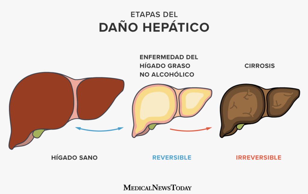¿Por qué se llama moderado? ¿Por qué se llama moderado?
