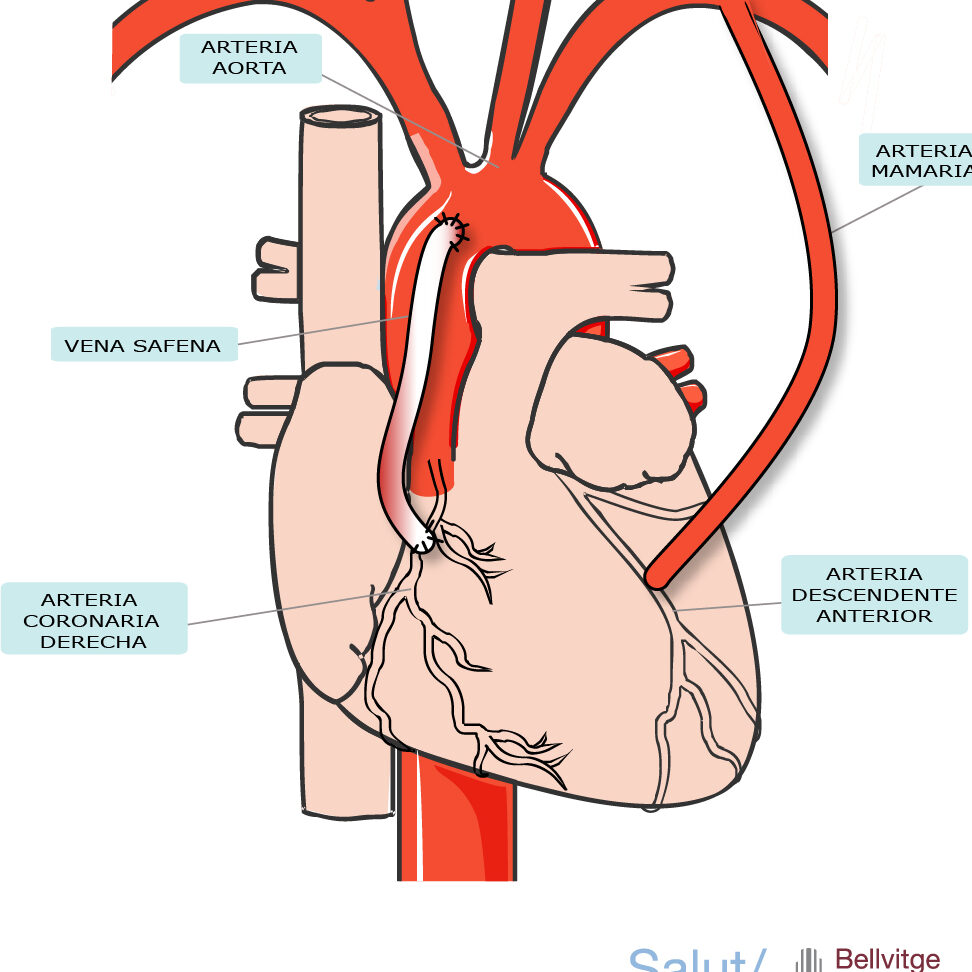 ¿Por qué se llama vena braquiocefálica? ¿Por qué se llama vena braquiocefálica?