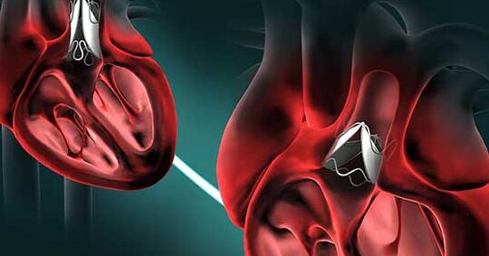 ¿Por qué se llaman tricúspide y mitral? ¿Por qué se llaman tricúspide y mitral?