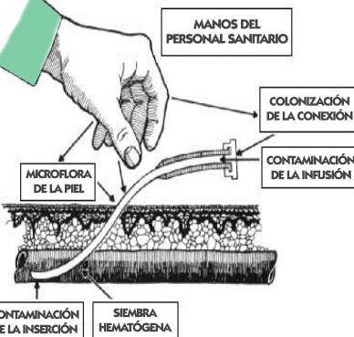 ¿Por qué se llaman vías enterales y parenterales?